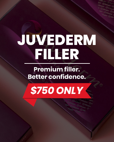 Juvederm Filler