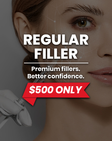 Regular Filler Deal