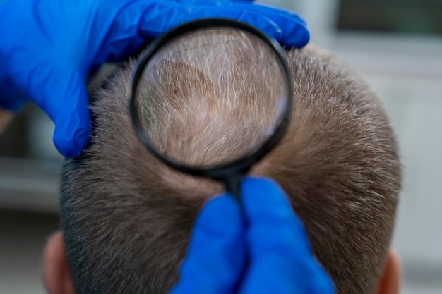 Scalp & Hair Analysis