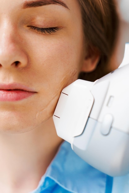 IPL photofacial treatment at Mediversity in Turnersville NJ