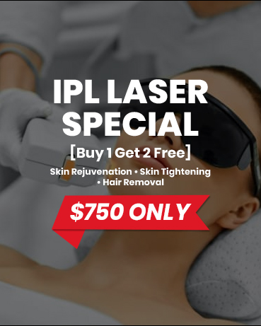 IPL Laser